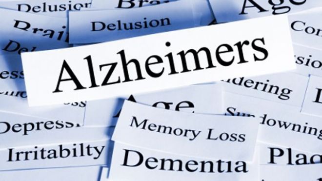 Alzheimer las vegas guardianship attorney